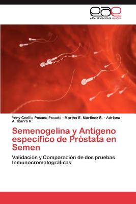 Semenogelina y Antigeno Especifico de Prostata En Semen - Posada Posada Yeny Cecilia, and Mart?nez B Martha E, and Ibarra R Adriana a