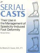 Serial Casts: Their Use in the Management of Spasticity Induced Foot Deformity