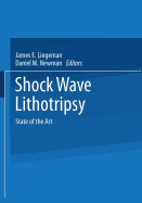Shock Wave Lithotripsy: State of the Art