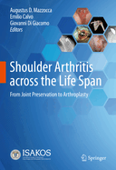 Shoulder Arthritis across the Life Span: From Joint Preservation to Arthroplasty