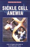 Sickle Cell Anemia