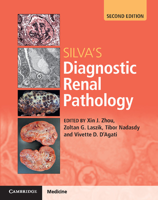 Silva's Diagnostic Renal Pathology - Zhou, Xin Jin (Joseph) (Editor), and Laszik, Zoltan G. (Editor), and Nadasdy, Tibor (Editor)