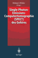 Single-Photon-Emissions-Computertomographie (Spect) Des Gehirns