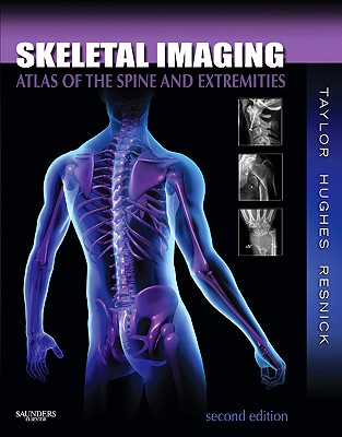 Skeletal Imaging: Atlas of the Spine and Extremities - Taylor, John A M, DC, and Hughes, Tudor H, MD, and Resnick, Donald L, MD