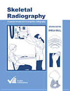 Skeletal Radiography: A Concise Introduction to Projection Radiography