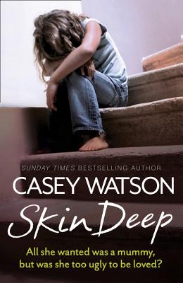 Skin Deep: All She Wanted Was a Mummy, But Was She Too Ugly to Be Loved? - Watson, Casey