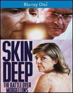 Skin Deep: The Battle Over Morgellons [Blu-ray]