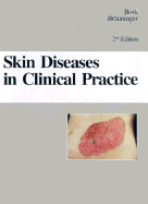 Skin Diseases in Clinical Practice