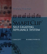 Smartclip Self-Ligating Appliance System: Concept and Biomechanics