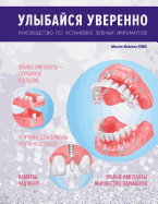 Smile with confidence (RUS): Your guide to dental implants