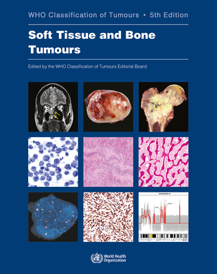 Soft Tissue and Bone Tumours: Who Classification of Tumours - Who Classification of Tumours Editorial Board
