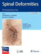 Spinal Deformities: The Comprehensive Text