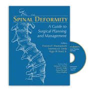 Spinal Deformity: A Guide to Surgical Planning and Management