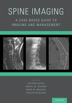 Spine Imaging: A Case-Based Guide to Imaging and Management - Gupta, Shivani (Editor), and Sciubba, Daniel M (Editor), and Mikhael, Mark M (Editor)