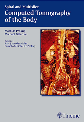 Spiral and Multislice Computed Tomography of the Body - Prokop, Mathias (Editor), and Galanski, Michael (Editor)