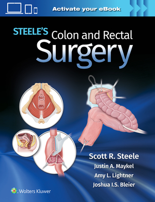 Steele's Colon and Rectal Surgery - Steele, Scott (Editor)