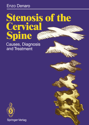 Stenosis of the Cervical Spine: Causes, Diagnosis and Treatment - Denaro, Vincenzo, and Mollica, Q (Foreword by), and Fornasier, V (Translated by)