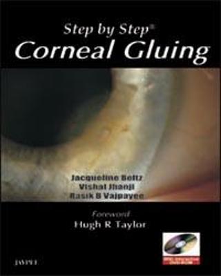 Step by Step: Corneal Gluing - Vajpayee, Rasik B, and Beltz, Jacqueline, and Jhanji, Vishal