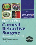 Step by Step: Corneal Refractive Surgery