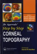 Step by Step Corneal Topography - Agarwal, Sunita, Dr. (Editor), and Agarwal, Athiya, Dr. (Editor), and Agarwal, Amar, Dr., MS, Frcs (Editor)