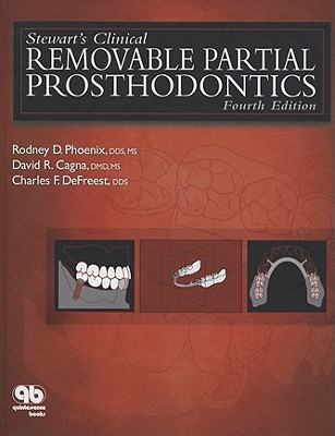 Stewart's Clinical Removable Partial Prosthodontics - Phoenix, Rodney D