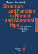 Structure and Function in Normal and Abnormal Hips: How to Rescue Mechanically Jeopardized Hips