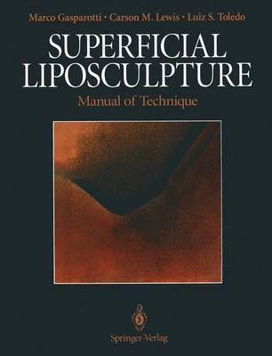 Superficial Liposculpture: Manual of Technique - Gasparotti, Marco, and Baroudi, R (Foreword by), and Lewis, Carson M