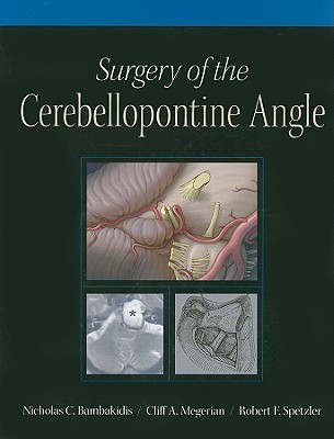 Surgery of the Cerebellopontine Angle - Bambakidis, Nicholas C