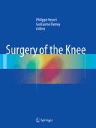 Surgery of the Knee