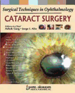 Surgical Techniques in Ophthalmology: Cataract Surgery