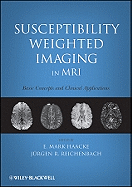 Susceptibility Weighted Imaging in MRI: Basic Concepts and Clinical Applications