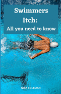 Swimmers Itch: All you need to know: What &#1089;&#1072;n be d&#1086;n&#1077; t&#1086; reduce the r&#1110;&#1109;k &#1086;f swimmer's itch?