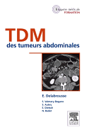 Tdm Des Tumeurs Abdominales