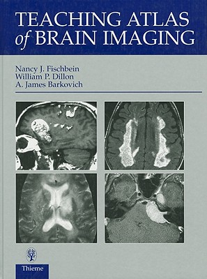 Teaching Atlas of Brain Imaging - Dillon, William P, and Barkovich, James A, and Fischbein, Efraim