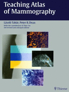 Teaching Atlas of Mammography - Tabar, Laszlo, and Dean, Peter B, and Tot, Tibor