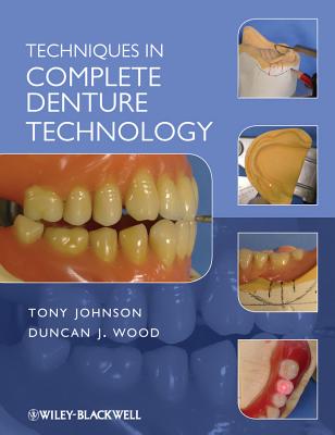 Techniques in Complete Denture Technology - Johnson, Tony (Editor), and Wood, Duncan J.