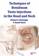 Techniques of Botulinum Toxin Injections in the Head and Neck