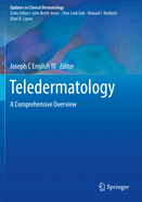 Teledermatology: A Comprehensive Overview