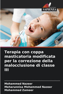 Terapia con coppa masticatoria modificata per la correzione della malocclusione di classe III