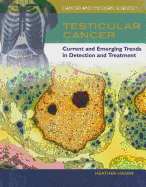 Testicular Cancer