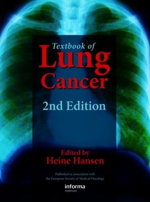 Textbook of Lung Cancer - Hansen, Heine (Editor)