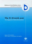 The 11-14-Week Scan: The Diagnosis of Fetal Abnormalities