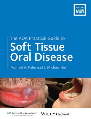 The ADA Practical Guide to Soft Tissue Oral Disease - Kahn, Michael A., and Hall, J. Michael