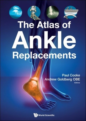 The Atlas of Ankle Replacements - Goldberg Obe, Andrew J (Editor), and Cooke, Paul H (Editor)