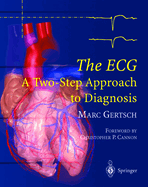 The ECG: A Two-Step Approach to Diagnosis