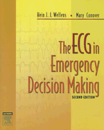 The ECG in emergency decision making