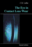 The Eye in Contact Lens Wear