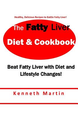 The Fatty Liver Diet & Cookbook: Beat Fatty Liver with Diet & Lifestyle Changes - Martin, Kenneth