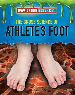 The Gross Science of Athlete's Foot - Kamberg, Mary-Lane