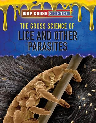 The Gross Science of Lice and Other Parasites - Olexa, Keith J